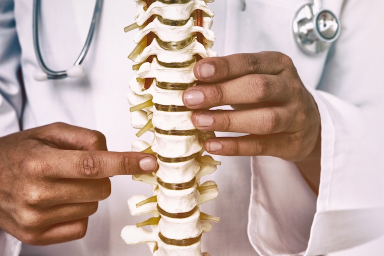 Understanding Spinal Injuries and Spinal Fusion