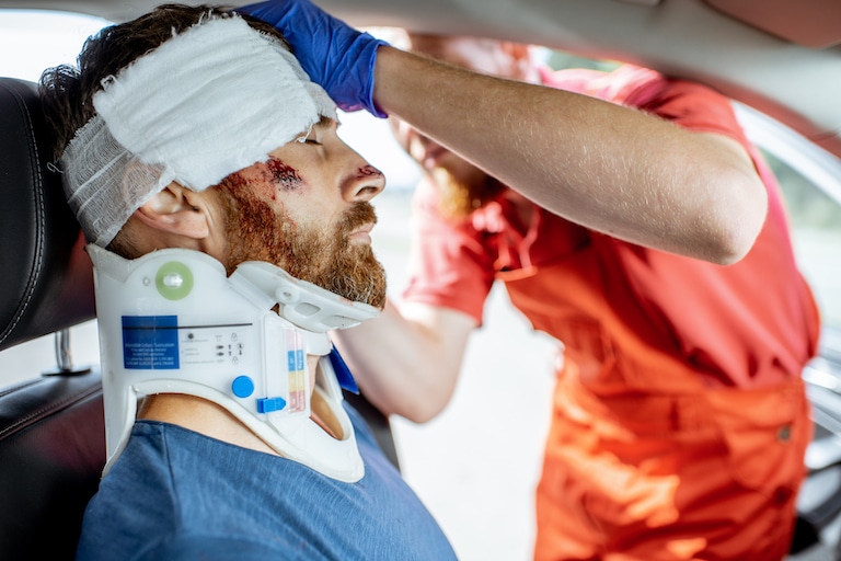 Common Head Injuries After Car Accidents