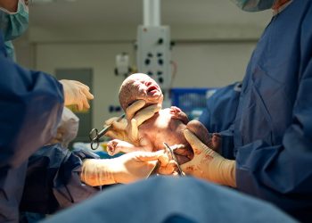 Cesarean Birth Injury
